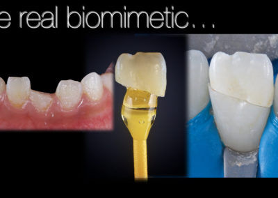 Reconstrucción biomimética Odontología