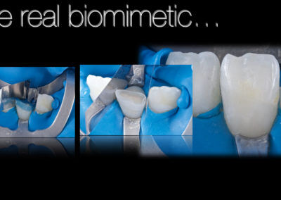 Odontología restauradora Biomimética