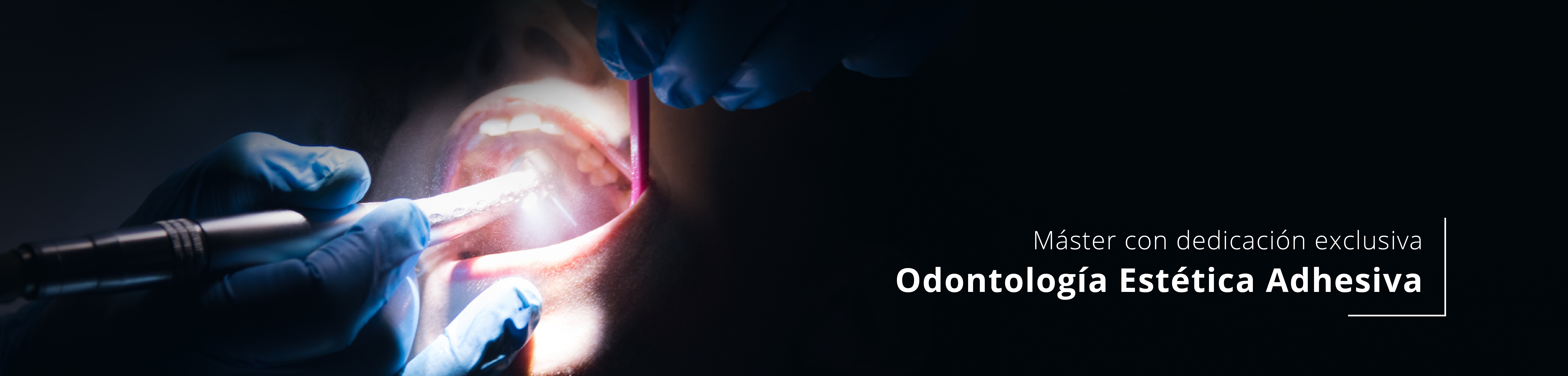 Odontología Estética y Rehabilitación Adhesiva (M.O.E.R.A-UCAM)